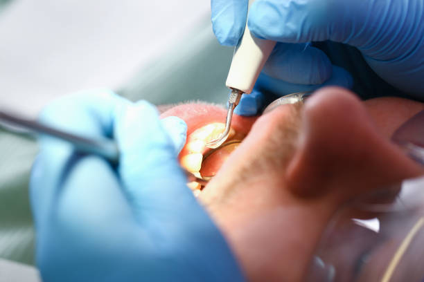 Best Knocked-Out Tooth Emergency  in Mogadore, OH