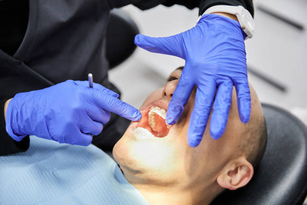 Best Teeth Whitening  in Mogadore, OH